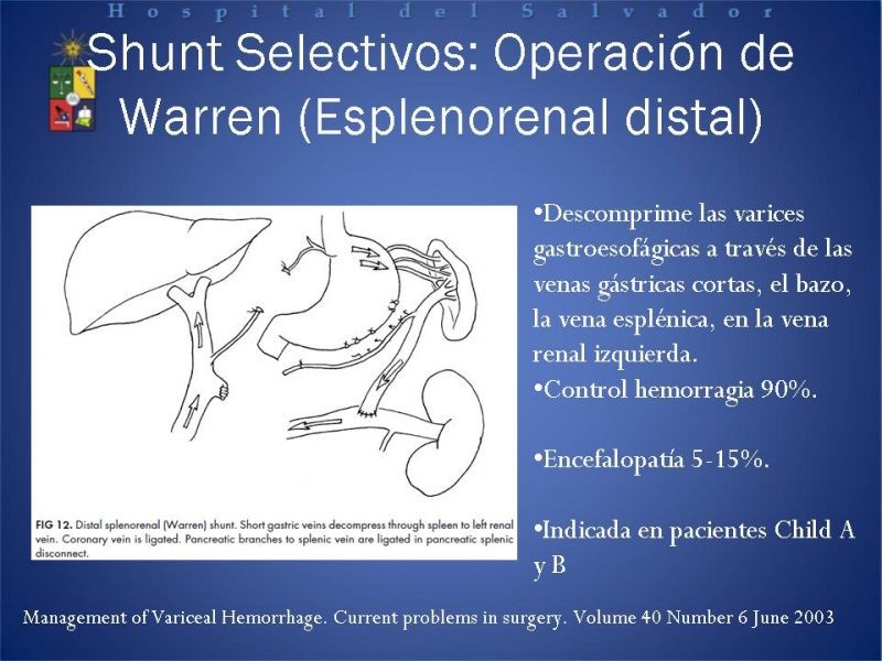 Diapositiva 27 de Hipertensión Portal:Alternativas Terapeuticas