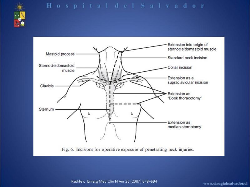 Diapositiva 28 de Trauma Vascular Cervical