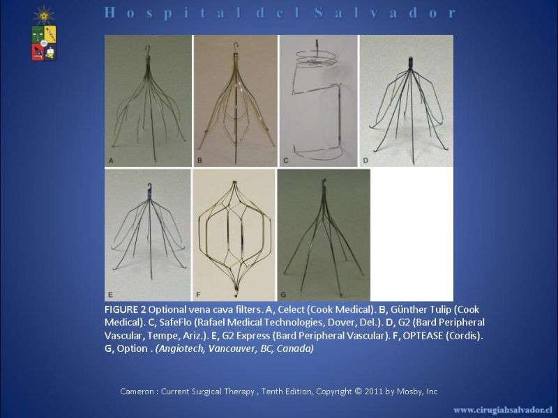 Diapositiva 9 de Filtro Vena Cava