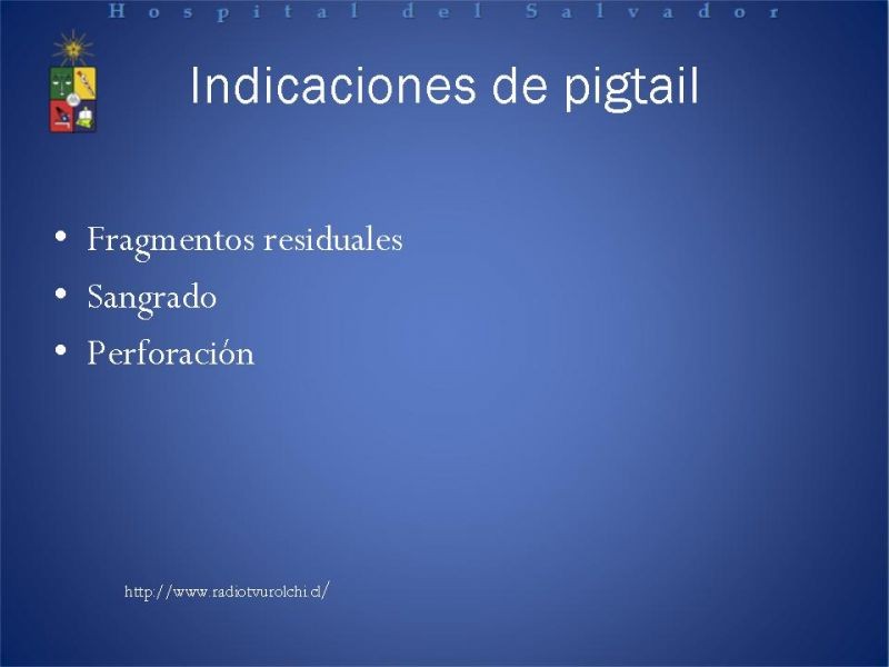 Diapositiva 18 de Urolitiasis