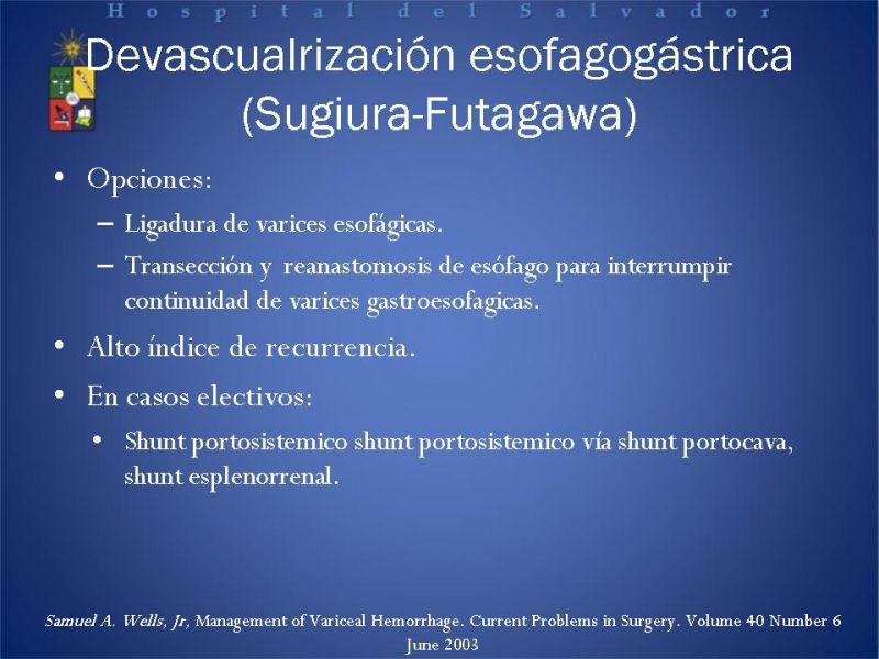 Diapositiva 19 de Hipertensión Portal:Alternativas Terapeuticas