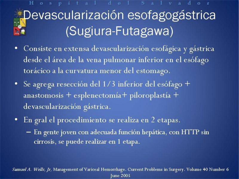 Diapositiva 20 de Hipertensión Portal:Alternativas Terapeuticas