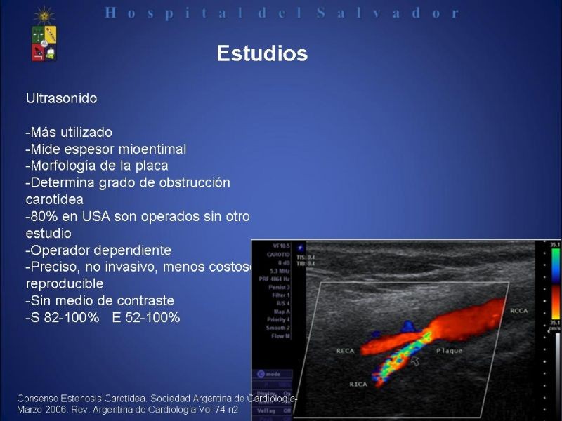 Diapositiva 6 de Patología Carotídea