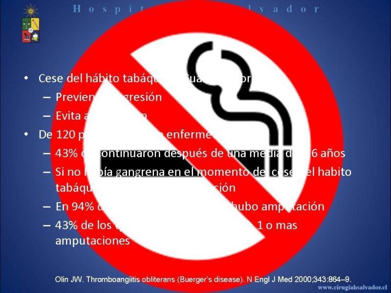 Diapositiva 25 de Tromboangeitis Obliterante(Enfermedad de Buerger)