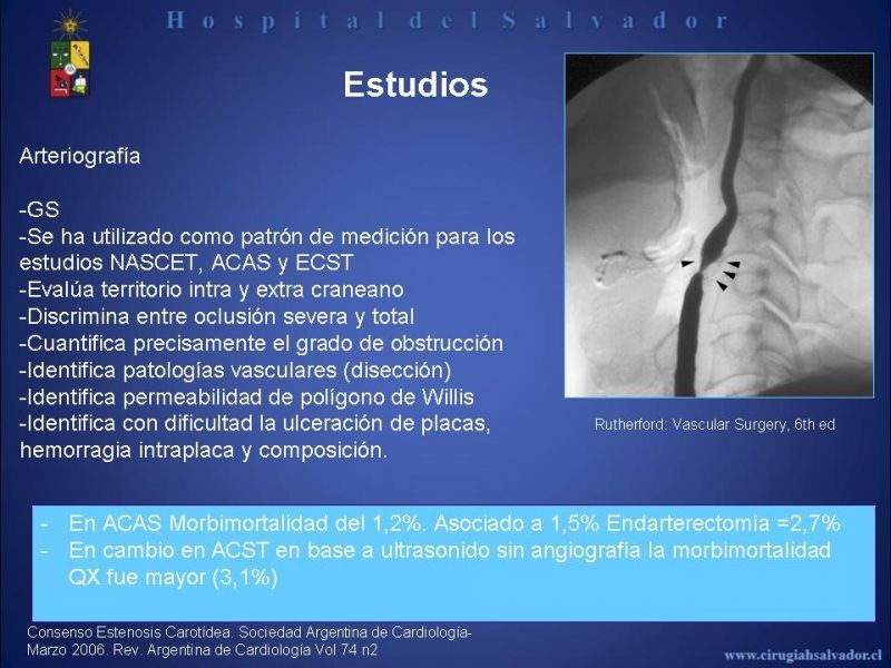 Diapositiva 9 de Patología Carotídea