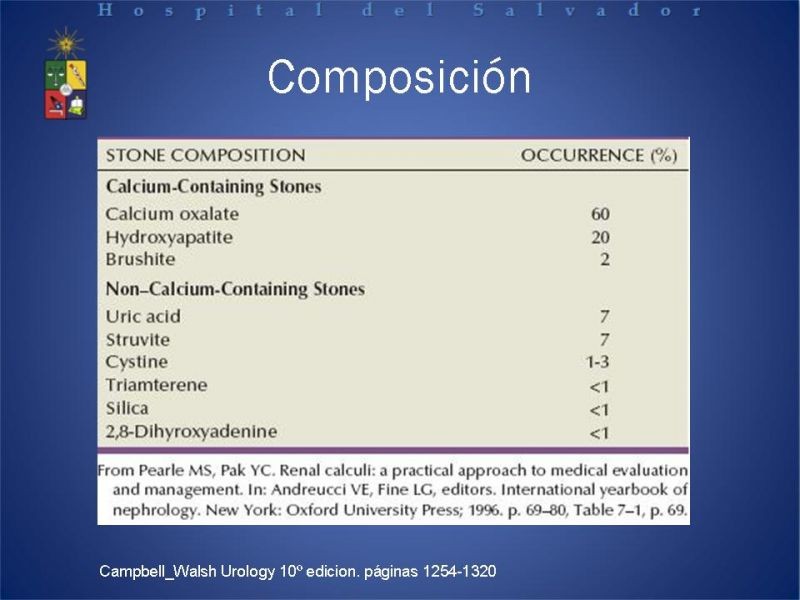 Diapositiva 5 de Urolitiasis