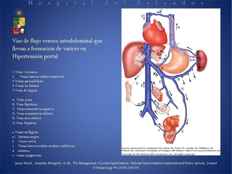 Diapositiva 6 de Hipertensión Portal:Alternativas Terapeuticas