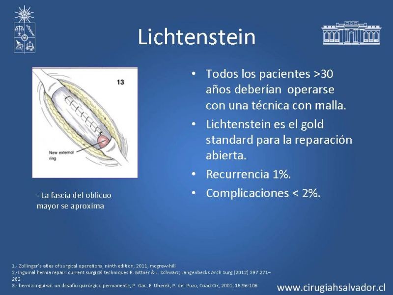 Diapositiva 12 de Hernia inguinal