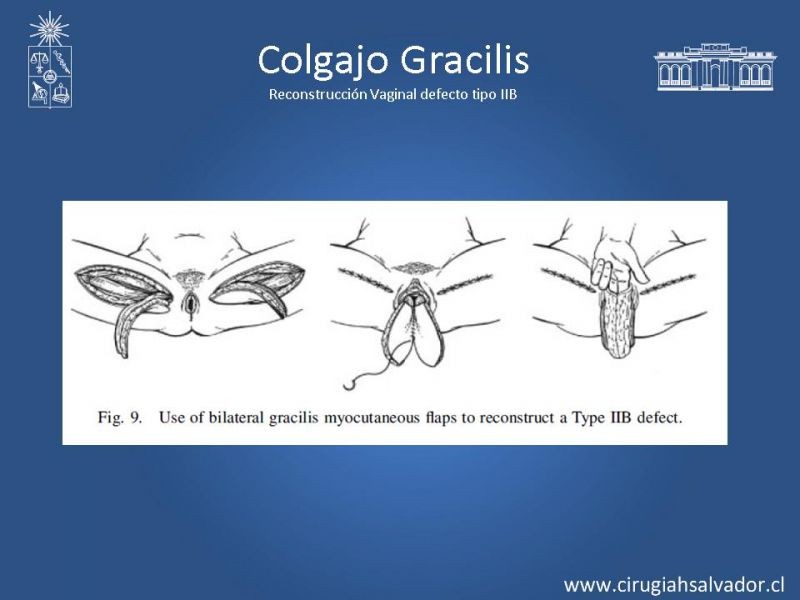 Diapositiva 27 de Transfusiones en Cirugía Mayor Abdominal pt. 2