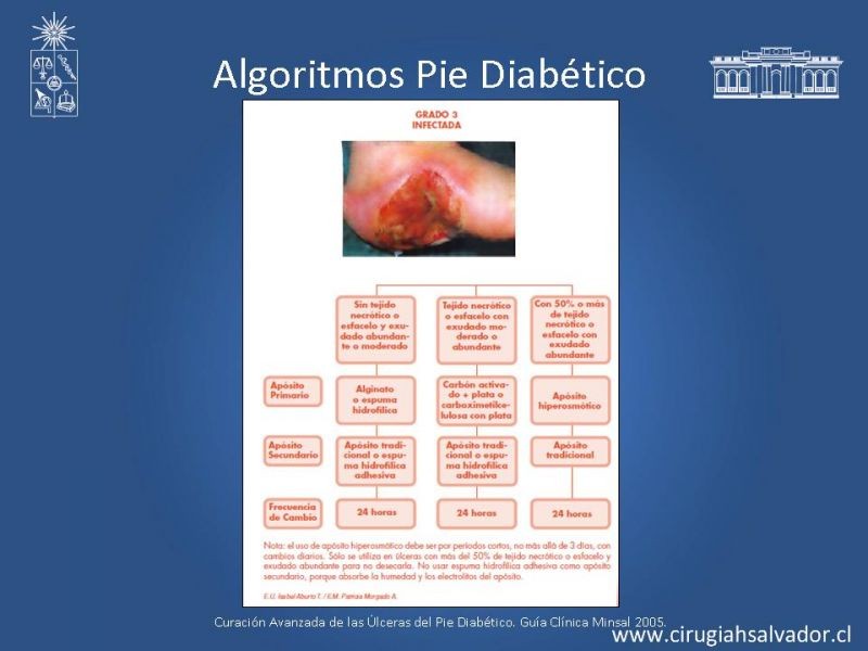 Diapositiva 43 de Pie Diabético: Curaciones Avanzadas