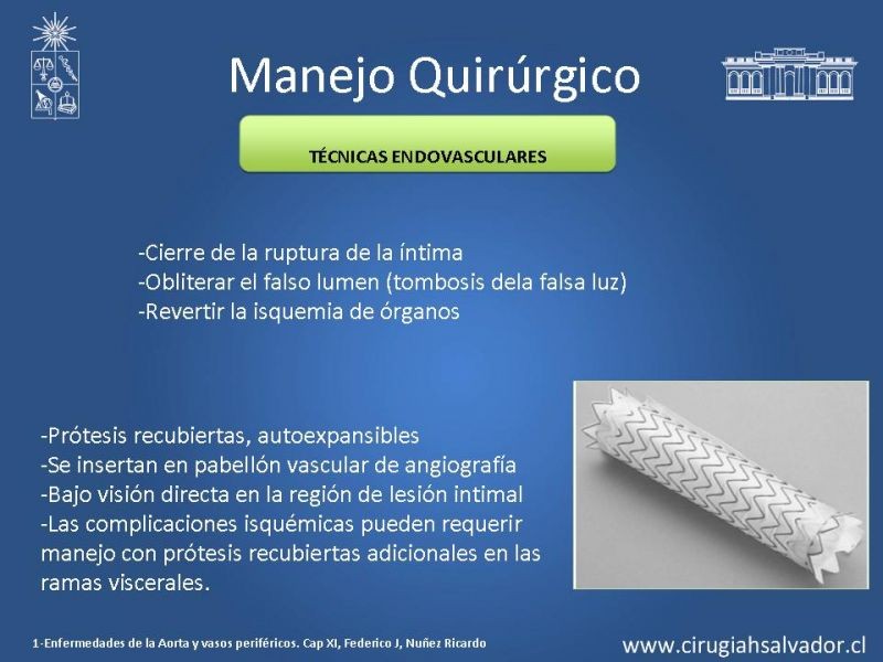Diapositiva 14 de Manejo Disección Aórtica Tipo B