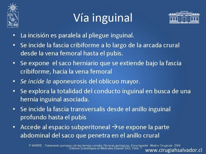 Diapositiva 21 de Hernia Crural 1