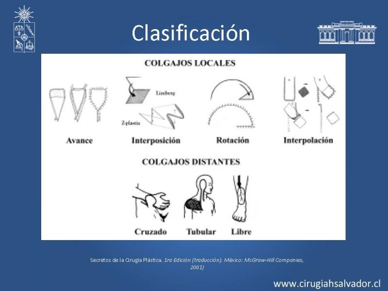 Diapositiva 3 de Colgajos útiles en cirugía general