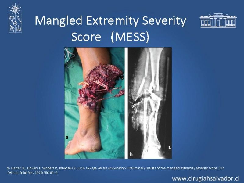 Diapositiva 13 de Score en Trauma de Extremidades