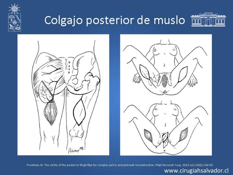 Diapositiva 34 de Transfusiones en Cirugía Mayor Abdominal pt. 2