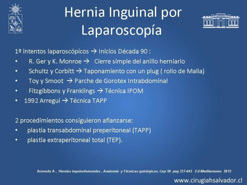 Diapositiva 6 de Laparoscopia en Hernia Inguinal