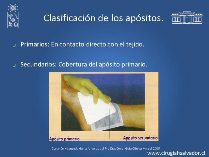 Diapositiva 21 de Pie Diabético: Curaciones Avanzadas