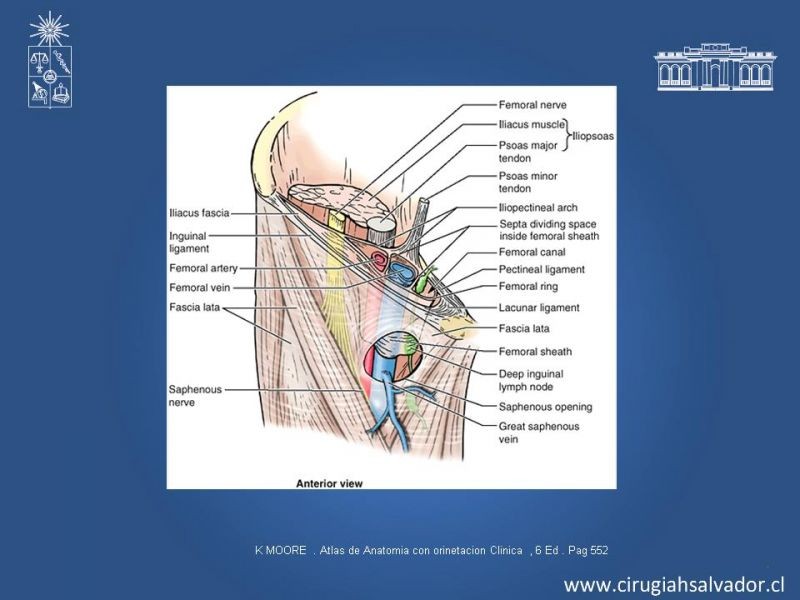 Diapositiva 2 de Hernia Crural 2