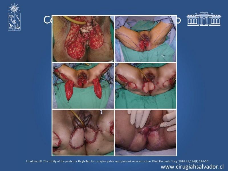 Diapositiva 37 de Transfusiones en Cirugía Mayor Abdominal pt. 2