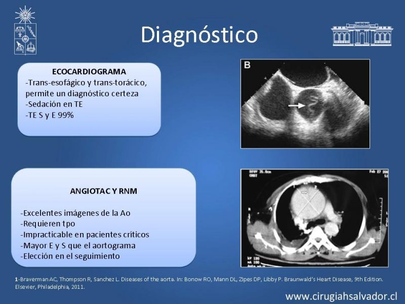 Diapositiva 10 de Manejo Disección Aórtica Tipo B