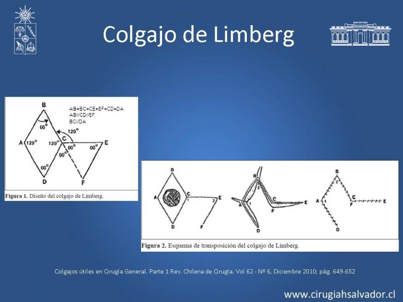 Diapositiva 9 de Colgajos útiles en cirugía general