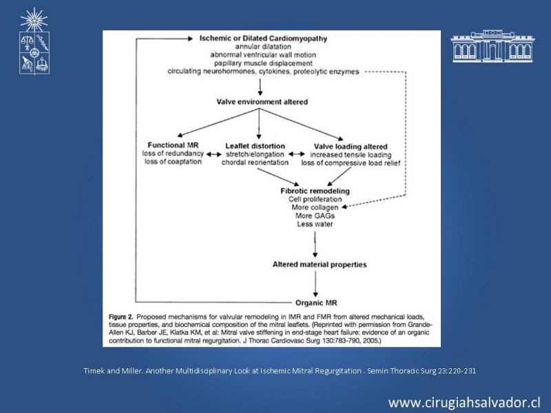 Diapositiva 5 de Insuficiencia Mitral Isquémica