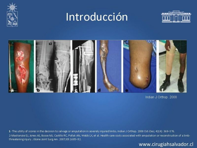 Diapositiva 3 de Score en Trauma de Extremidades