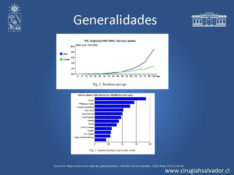 Diapositiva 2 de Tumores Glándulas Salivares