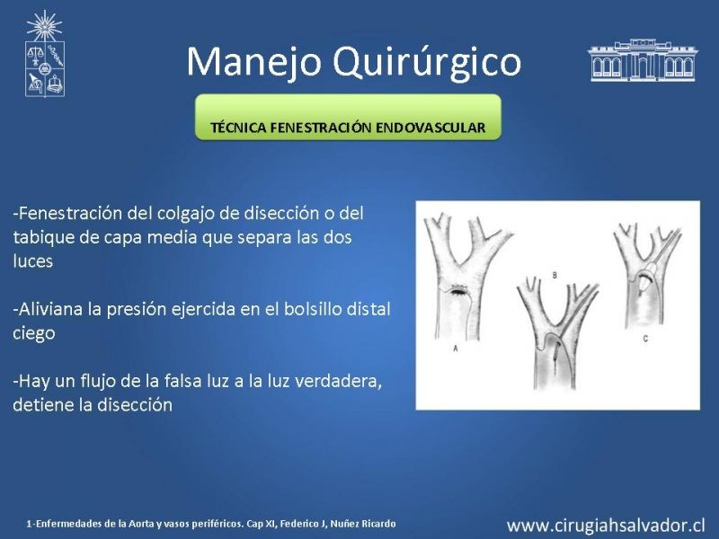 Diapositiva 16 de Manejo Disección Aórtica Tipo B