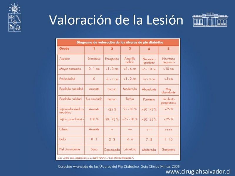Diapositiva 4 de Pie Diabético: Curaciones Avanzadas