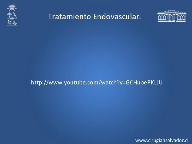 Diapositiva 17 de Reparación endovascular de aneurismas de aorta torácica (TEVAR)