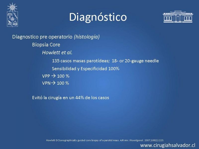 Diapositiva 16 de Tumores Glándulas Salivares