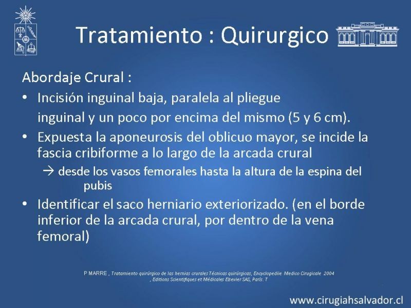 Diapositiva 7 de Hernia Crural 2
