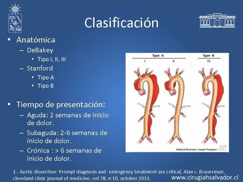 Diapositiva 2 de Disección aórtica tipo A