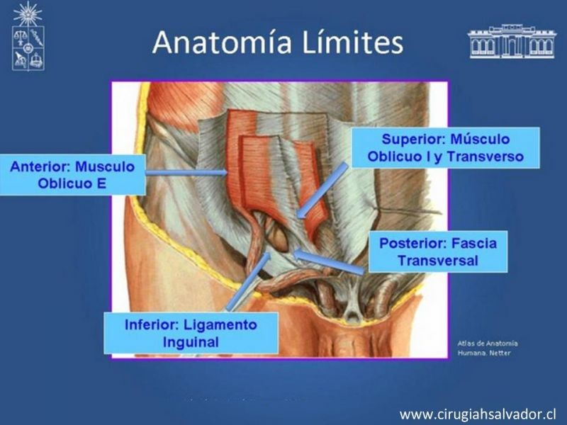 Diapositiva 2 de Laparoscopia en Hernia Inguinal