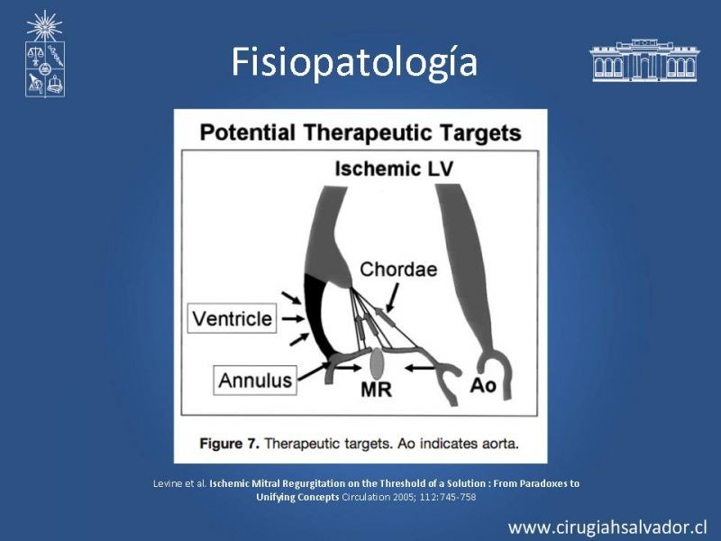 Diapositiva 10 de Insuficiencia Mitral Isquémica