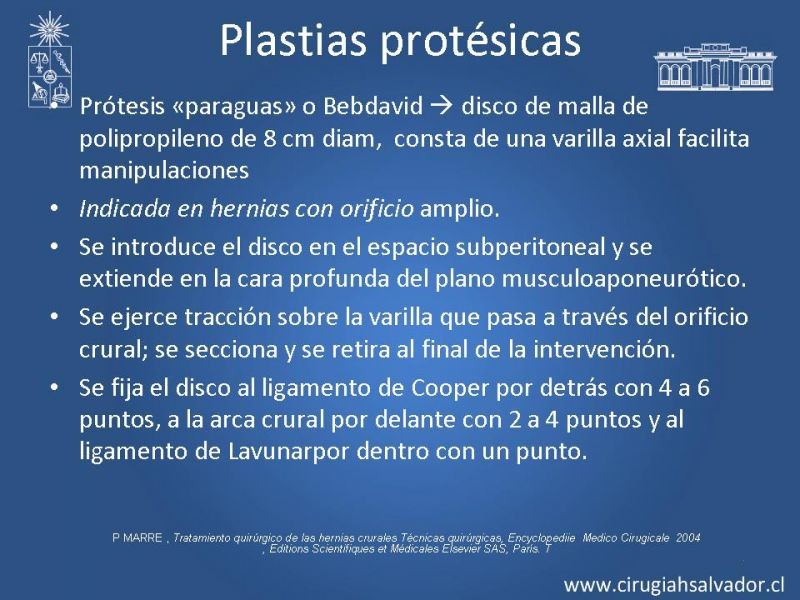 Diapositiva 28 de Hernia Crural 1