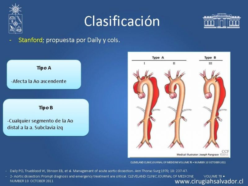 Diapositiva 5 de Manejo Disección Aórtica Tipo B