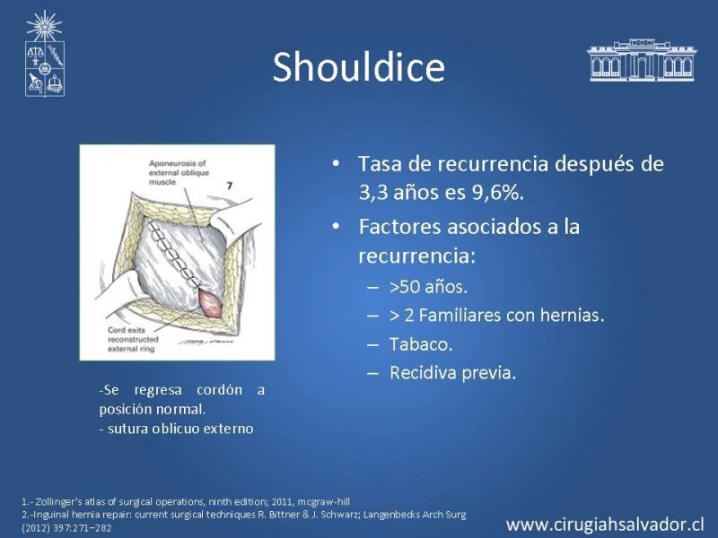 Diapositiva 9 de Hernia inguinal