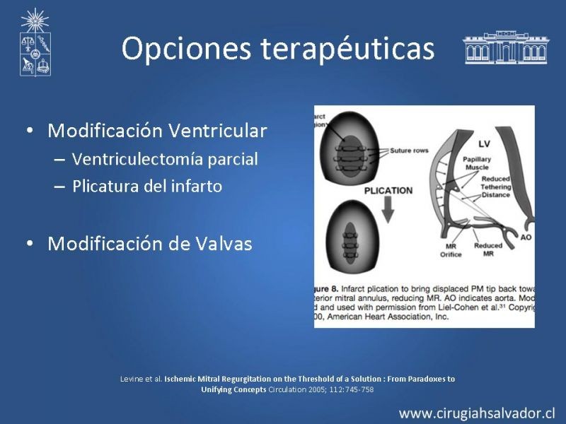 Diapositiva 12 de Insuficiencia Mitral Isquémica