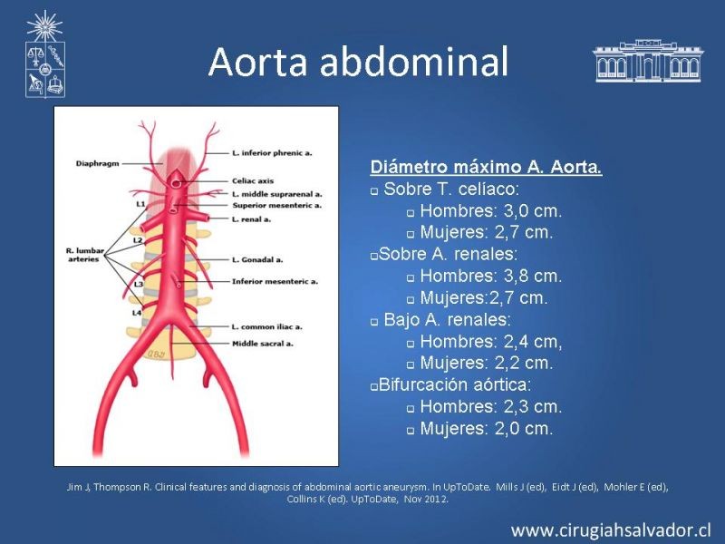 Diapositiva 3 de Aneurisma de Aorta Abdominal:Generalidades