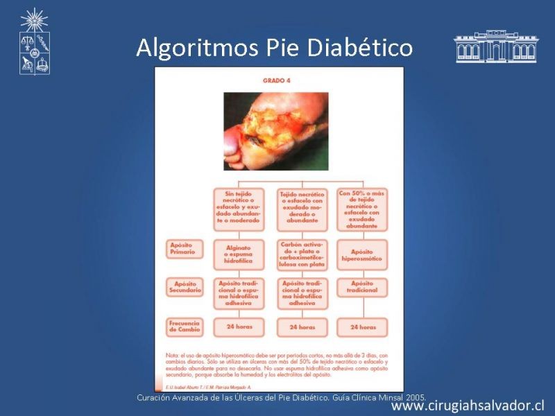 Diapositiva 44 de Pie Diabético: Curaciones Avanzadas