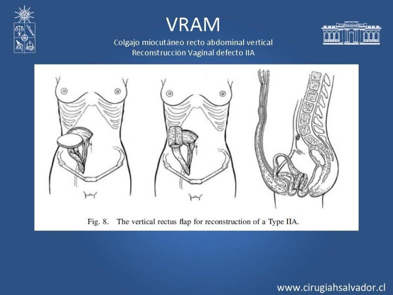 Diapositiva 16 de Transfusiones en Cirugía Mayor Abdominal pt. 2