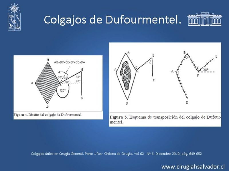 Diapositiva 11 de Colgajos útiles en cirugía general