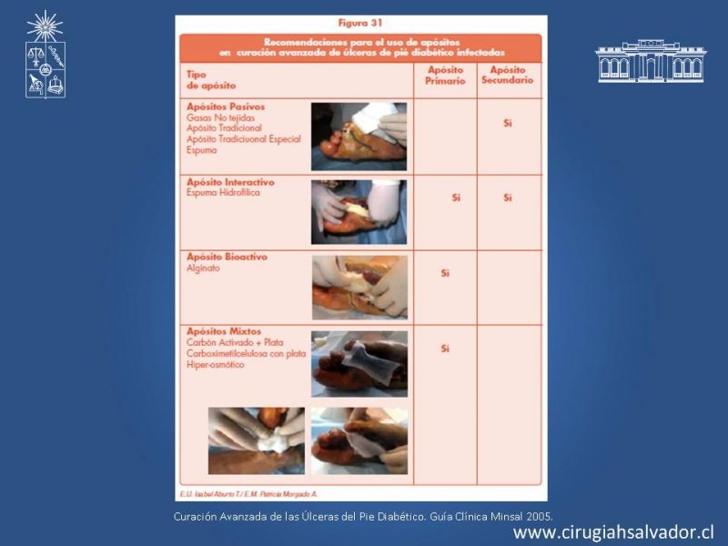 Diapositiva 22 de Pie Diabético: Curaciones Avanzadas
