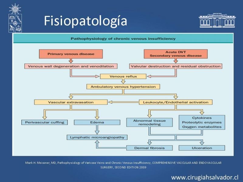 Diapositiva 5 de Insuficiencia Venosa superficial