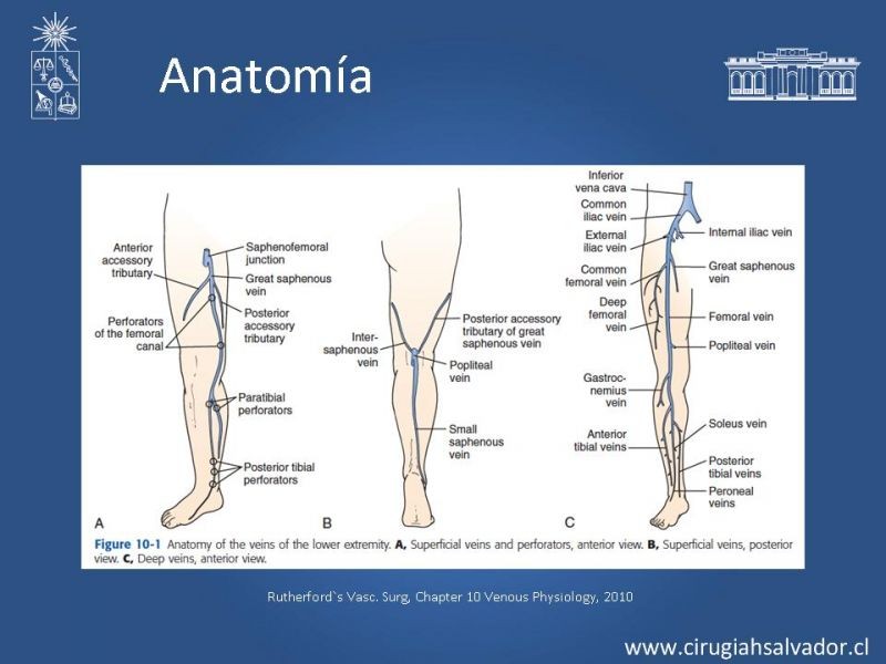 Diapositiva 3 de Insuficiencia Venosa superficial