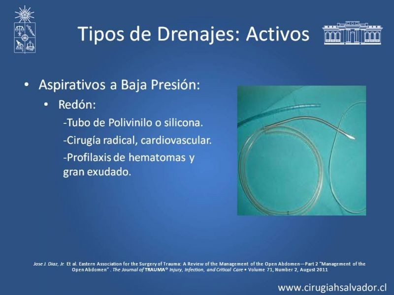 Diapositiva 21 de Drenajes: Indicación y Utilidad