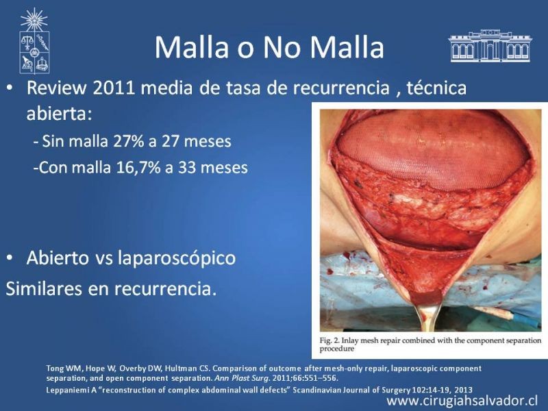 Diapositiva 8 de Separación de Componentes