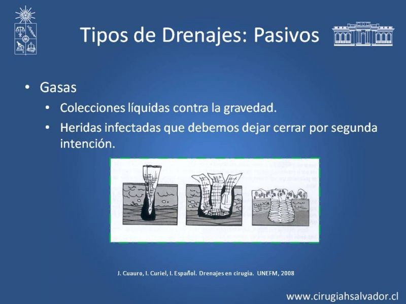 Diapositiva 15 de Drenajes: Indicación y Utilidad